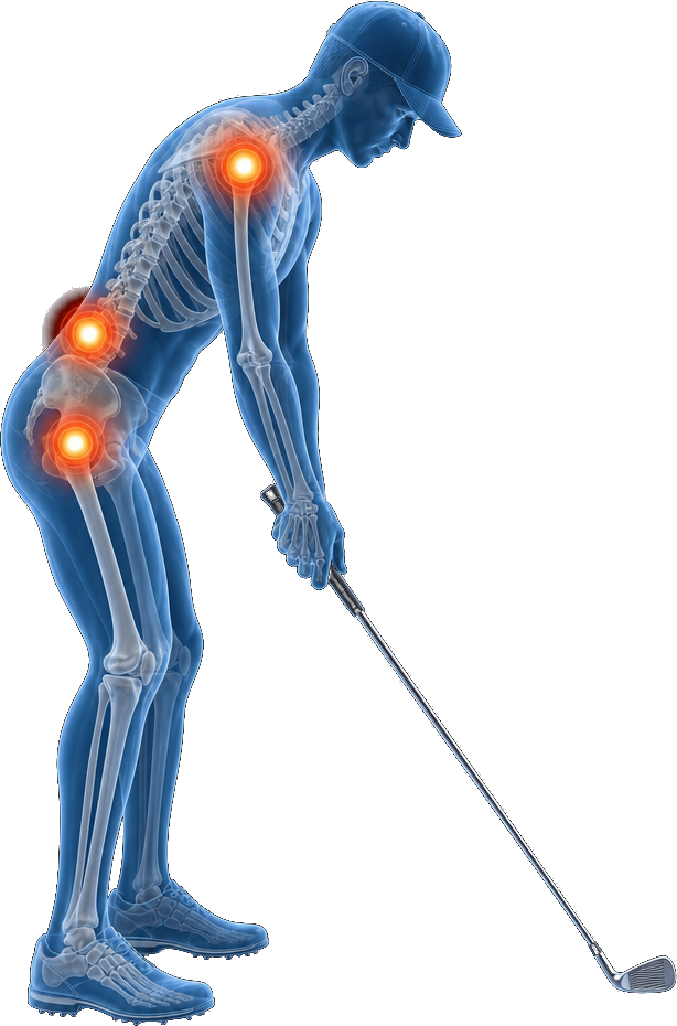 Anatomical illustration of a golfer with glowing pain points at the shoulder, lower back, and hip